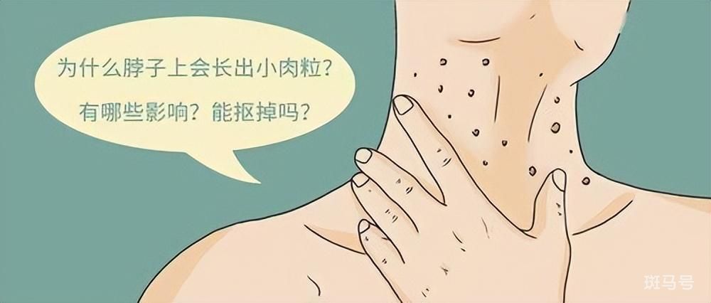 脖子和腋下的“小肉粒”是什么（怎么避免小肉粒的产生）(图5)